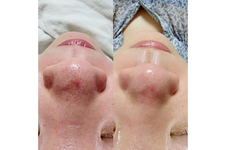 BeautyPlus_20230511160433762_save
