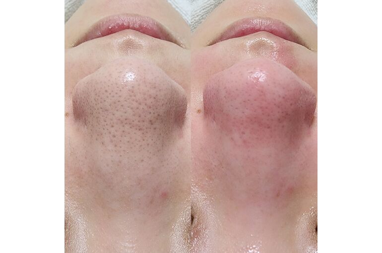 BeautyPlus_20230601202711324_save