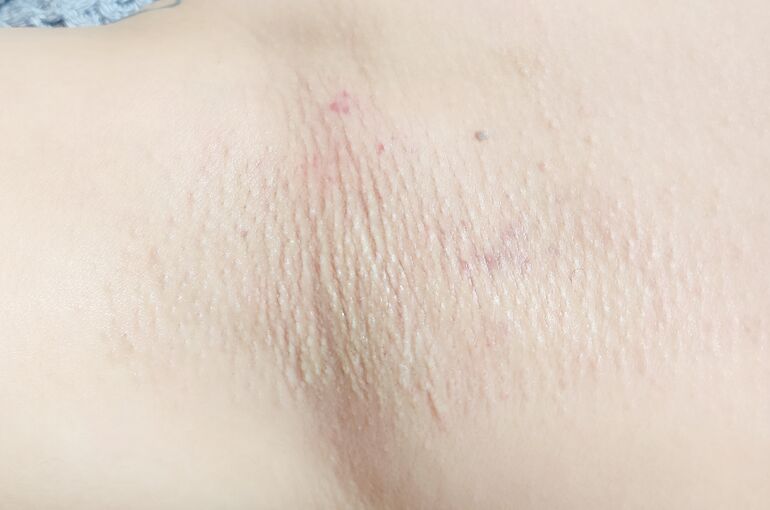 BeautyPlus_20240514214109492_save